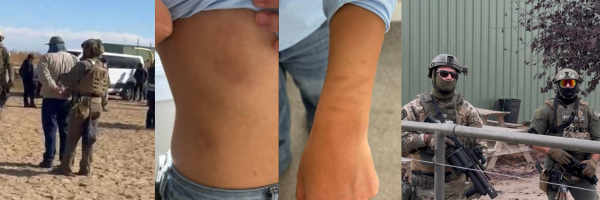 Images of immigration enforcement and a young girl's injured wrists from being zip-tied